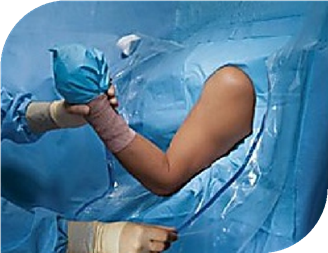 SHOULDER ARTHROSCOPY DRAPE